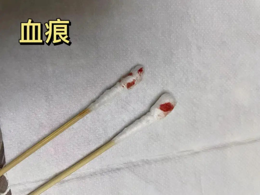 亲子鉴定样本采集棉棒上的血痕可以吗？