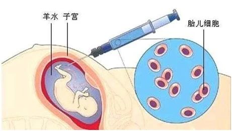 无创胎儿亲子鉴定、羊水亲子鉴定、毛发亲子鉴定分别怎么做？