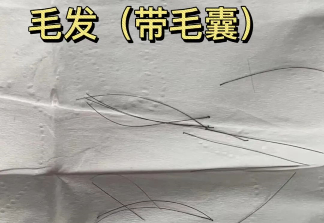 亲子鉴定样本采集棉棒上的血痕可以吗？
