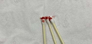 个人亲子鉴定可以邮寄血样检材吗？样本有哪些注意事项？