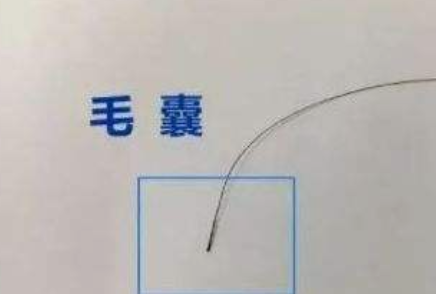 什么是亲子判定？小梅与陈姑娘的故事