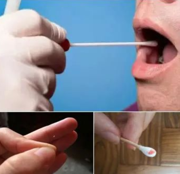 亲子鉴定人可以自己在家取口腔棉签样本吗？