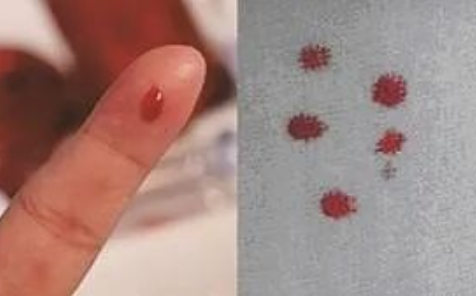 匿名亲子鉴定需要准备什么？亲子鉴定工作人员采样本流程有哪些？
