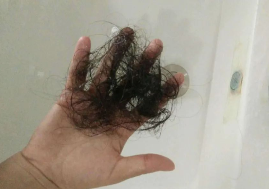 毛发可以做亲子鉴定检材吗，怎么采集样本才可以？