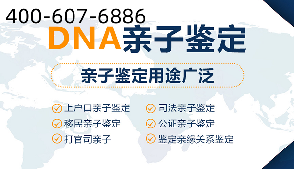 中山上户口亲子鉴定办理有什么注意事项吗？