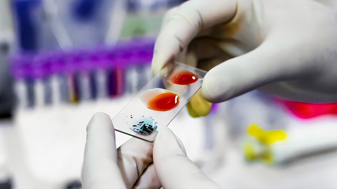 怎么用头发做中山dna个人隐私亲子鉴定？