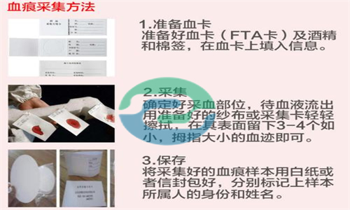 保险继承需要做中山DNA亲子鉴定？