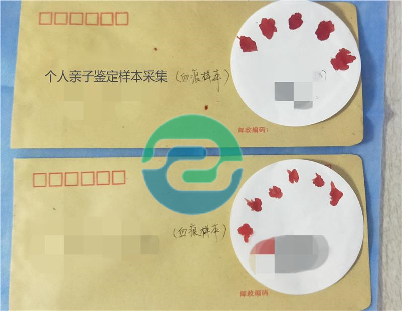 孕期中山亲子鉴定结果准确吗？能相信结论吗？