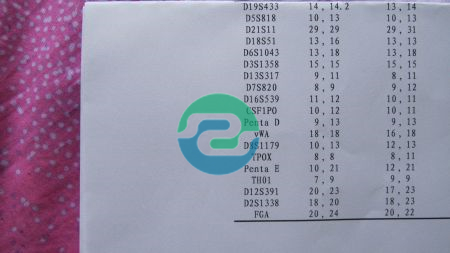 中山亲子鉴定有法律效力吗？盛泽基因